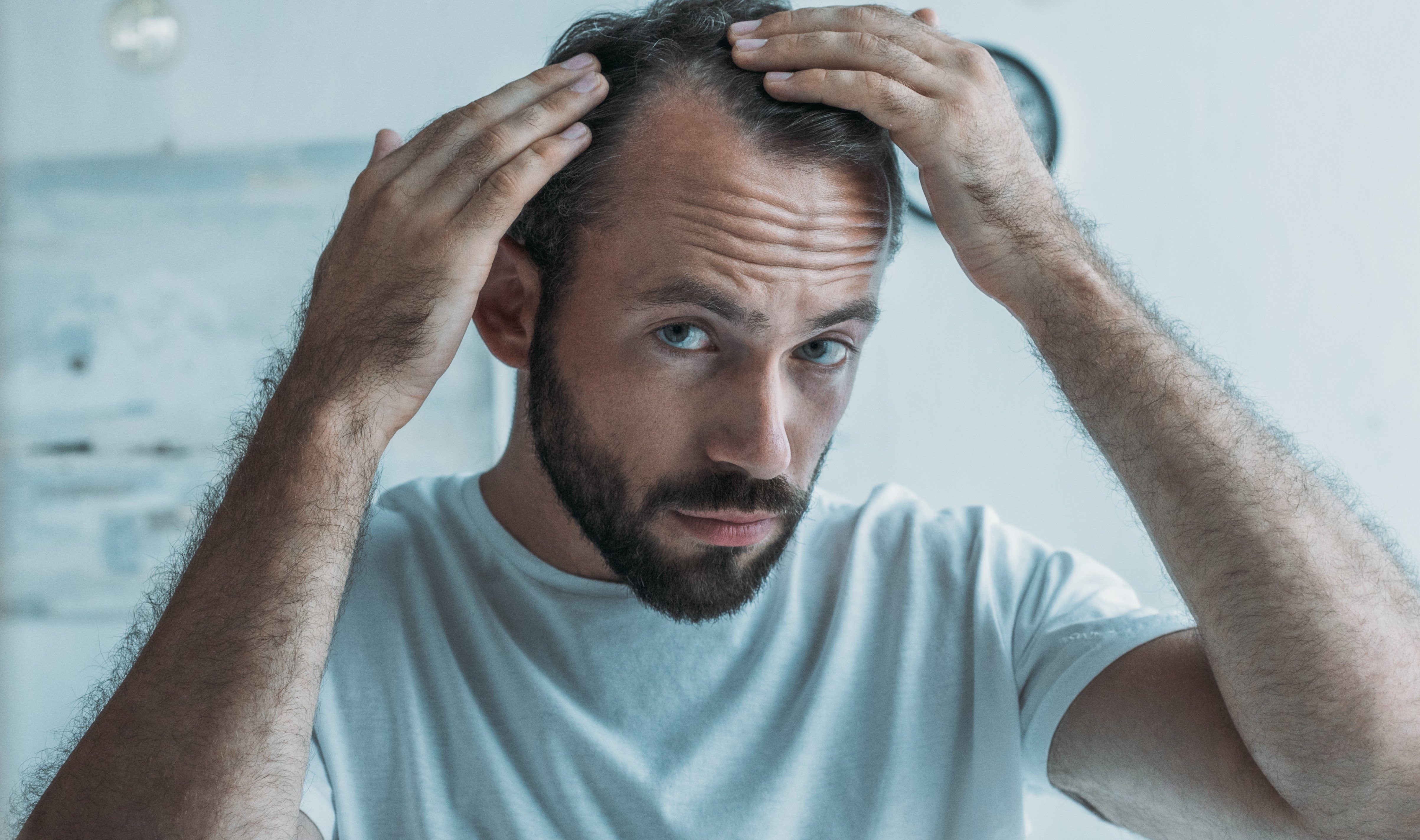 Hair Loss (Alopecia) and Cancer Treatment | Bond Hair Bar